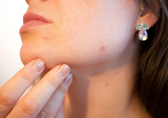 Jak sobie poradzić z alergią na kosmetyki?