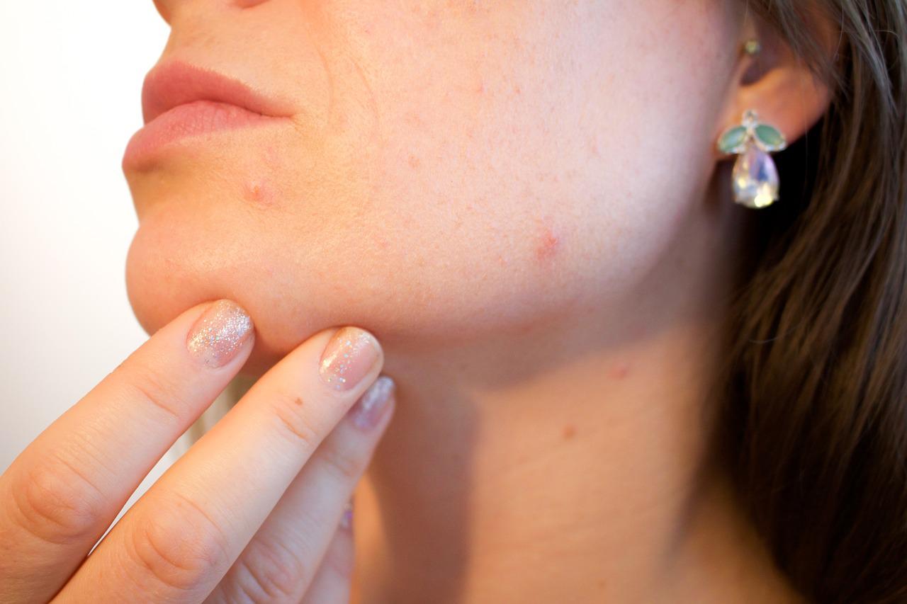 Jak sobie poradzić z alergią na kosmetyki?